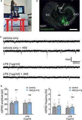 Interleukin 10 Restores Lipopolysaccharide-Induced Alterations in Synaptic Plasticity Probed by Repetitive Magnetic Stimulation